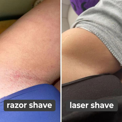 Last Day 50% OFF I  Laser Hair Remover